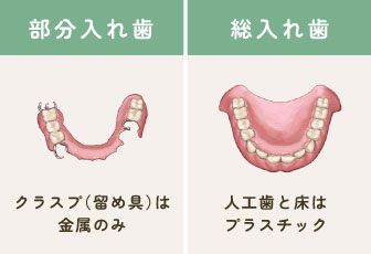 保険診療の入れ歯