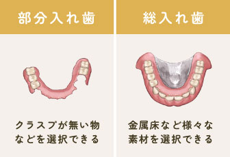 自由診療（自費診療）の入れ歯